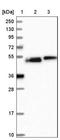 Coiled-Coil Domain Containing 81 antibody, NBP1-91764, Novus Biologicals, Western Blot image 