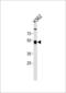 Zinc Finger Protein 500 antibody, LS-C157461, Lifespan Biosciences, Western Blot image 