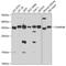 Charged multivesicular body protein 4b antibody, GTX64853, GeneTex, Western Blot image 