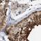 RuvB Like AAA ATPase 1 antibody, NBP1-84914, Novus Biologicals, Immunohistochemistry paraffin image 