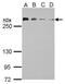 Chromodomain Helicase DNA Binding Protein 4 antibody, PA5-32181, Invitrogen Antibodies, Western Blot image 