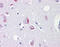 Aspartyl-TRNA Synthetase antibody, 51-447, ProSci, Immunohistochemistry paraffin image 