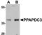 Phospholipid Phosphatase 7 (Inactive) antibody, TA306887, Origene, Western Blot image 