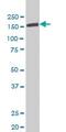 Tyrosine Kinase 2 antibody, ab57678, Abcam, Western Blot image 