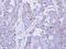 Desmocollin 2 antibody, LS-C186031, Lifespan Biosciences, Immunohistochemistry paraffin image 