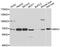 Ribophorin I antibody, A05063, Boster Biological Technology, Western Blot image 