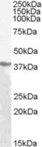 pan ADH antibody, EB06599, Everest Biotech, Western Blot image 