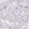 Hypocretin Receptor 2 antibody, HPA054516, Atlas Antibodies, Immunohistochemistry paraffin image 