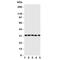 Aquaporin 9 antibody, R31206, NSJ Bioreagents, Western Blot image 