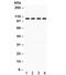 Protein Tyrosine Phosphatase Non-Receptor Type 22 antibody, R32361, NSJ Bioreagents, Western Blot image 