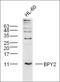 Testis-specific basic protein Y 2 antibody, orb155863, Biorbyt, Western Blot image 