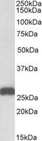 Electron Transfer Flavoprotein Subunit Beta antibody, PA5-19337, Invitrogen Antibodies, Western Blot image 