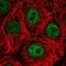 Death Effector Domain Containing antibody, NBP2-76527, Novus Biologicals, Immunocytochemistry image 