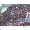 Galactosidase Beta 1 antibody, LS-C814157, Lifespan Biosciences, Immunohistochemistry paraffin image 