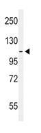 EPH Receptor A2 antibody, abx033512, Abbexa, Immunohistochemistry paraffin image 