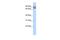 Tripartite Motif Containing 67 antibody, PA5-42274, Invitrogen Antibodies, Western Blot image 