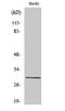 CD70 Molecule antibody, STJ92139, St John