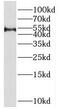 Sperm Associated Antigen 6 antibody, FNab08144, FineTest, Western Blot image 