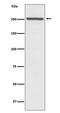 Notch Receptor 4 antibody, M02582, Boster Biological Technology, Western Blot image 