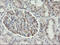 Phosphorylase Kinase Catalytic Subunit Gamma 2 antibody, M07871, Boster Biological Technology, Immunohistochemistry paraffin image 