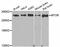 Mechanistic Target Of Rapamycin Kinase antibody, A11355, ABclonal Technology, Western Blot image 