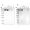 Exportin 5 antibody, PA5-56293, Invitrogen Antibodies, Western Blot image 