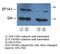 Eukaryotic Translation Elongation Factor 1 Alpha 1 antibody, LS-C99326, Lifespan Biosciences, Western Blot image 