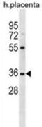 Olfactory Receptor Family 5 Subfamily AN Member 1 antibody, abx026912, Abbexa, Western Blot image 