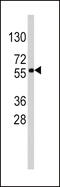 SRY-Box 9 antibody, 57-474, ProSci, Western Blot image 