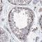 Spermine Synthase antibody, NBP1-87812, Novus Biologicals, Immunohistochemistry frozen image 