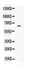 Cytoskeleton Associated Protein 4 antibody, A02154-1, Boster Biological Technology, Western Blot image 