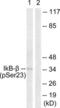 NFKB Inhibitor Beta antibody, LS-C199099, Lifespan Biosciences, Western Blot image 