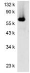 Firefly Luciferase antibody, MBS395251, MyBioSource, Western Blot image 