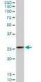 Calpain Small Subunit 1 antibody, H00000826-M01, Novus Biologicals, Western Blot image 