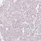 Calpain 3 antibody, HPA040052, Atlas Antibodies, Immunohistochemistry frozen image 