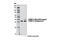 Proteasome 26S Subunit, Non-ATPase 14 antibody, 4197S, Cell Signaling Technology, Western Blot image 