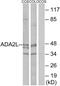 TADA2A antibody, PA5-38547, Invitrogen Antibodies, Western Blot image 