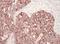 Heat Shock Protein Family D (Hsp60) Member 1 antibody, A302-846A, Bethyl Labs, Immunohistochemistry paraffin image 