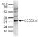 SAGA Complex Associated Factor 29 antibody, TA347094, Origene, Western Blot image 