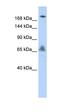 VPS8 Subunit Of CORVET Complex antibody, orb325050, Biorbyt, Western Blot image 