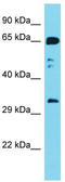 Receptor For Activated C Kinase 1 antibody, TA343147, Origene, Western Blot image 