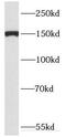 DExH-Box Helicase 29 antibody, FNab02377, FineTest, Western Blot image 