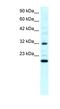Rho GDP Dissociation Inhibitor Gamma antibody, NBP1-59112, Novus Biologicals, Western Blot image 