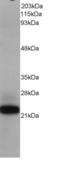 MYC Associated Factor X antibody, STJ70025, St John