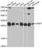 Guanidinoacetate N-Methyltransferase antibody, STJ28680, St John