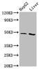 Adipocyte Plasma Membrane Associated Protein antibody, CSB-PA884629LA01HU, Cusabio, Western Blot image 