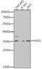 HUS1 Checkpoint Clamp Component antibody, 19-646, ProSci, Western Blot image 