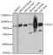 Glutamate-Cysteine Ligase Catalytic Subunit antibody, GTX66057, GeneTex, Western Blot image 