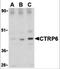 C1q And TNF Related 6 antibody, 3577, ProSci, Western Blot image 