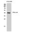 cAMP-dependent protein kinase catalytic subunit gamma antibody, STJ95116, St John